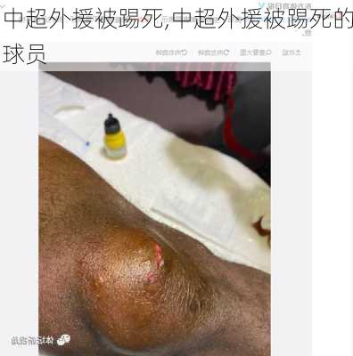 中超外援被踢死,中超外援被踢死的球员