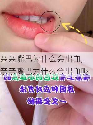 亲亲嘴巴为什么会出血,亲亲嘴巴为什么会出血呢